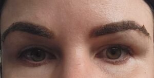 8 days post Powderbrows peeling